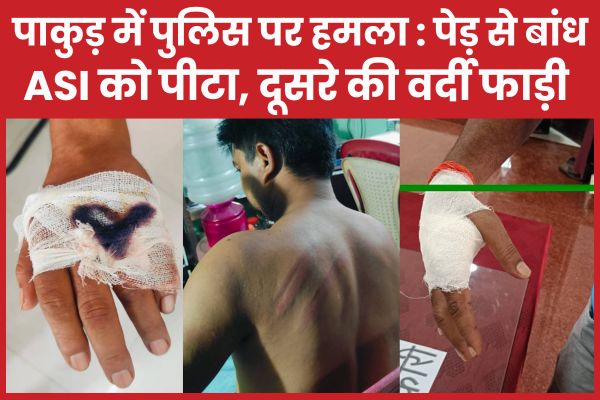 पाकुड़ में पुलिस पर ह’मला : पेड़ से बांधकर ASI को पी’टा, दूसरे की वर्दी फाड़ी पाकुड़