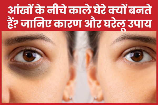 आंखों के नीचे काले घेरे क्यों बनते हैं? जानिए कारण और घरेलू उपाय आंखें
